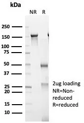 SDS-PAGE Analysis of Purified CD23 Mouse Monoclonal Antibody (FCER2/6893). Confirmation of Purity and Integrity of Antibody.
