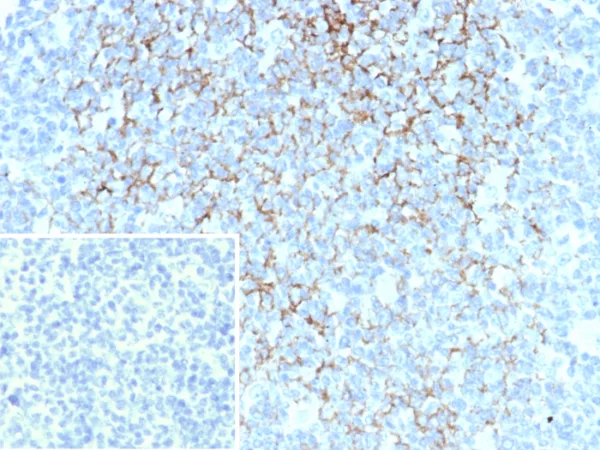 IHC analysis of formalin-fixed, paraffin-embedded human tonsil. Membrane stained using FCER2/6893 at 2ug/ml in PBS for 30min RT. Inset: PBS instead of primary antibody; secondary only negative control.
