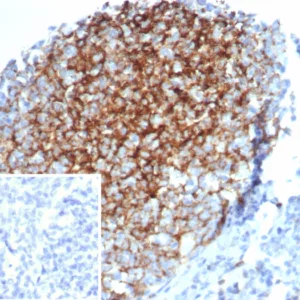 IHC analysis of formalin-fixed, paraffin-embedded human tonsil. Membrane stained using FCER2/6889 at 2ug/ml in PBS for 30min RT. Inset: PBS instead of primary antibody; secondary only negative control.