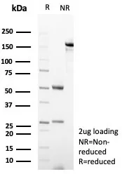 SDS-PAGE Analysis of Purified CD23 Recombinant Rabbit Monoclonal Antibody (FCER2/8234R). Confirmation of Purity and Integrity of Antibody.