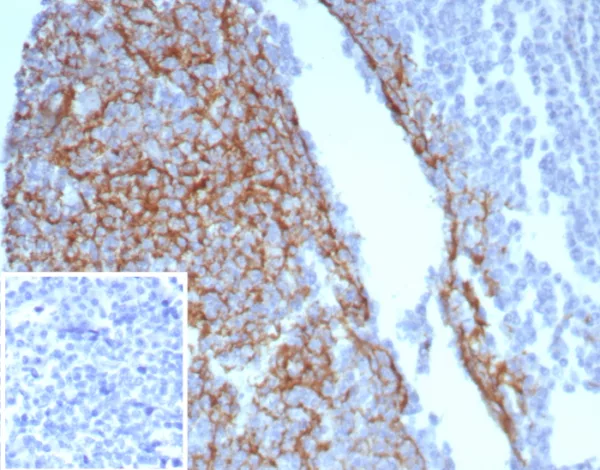Formalin-fixed, paraffin-embedded human tonsil stained with CD23 Recombinant Rabbit Monoclonal Antibody (FCER2/8234R). Inset: PBS instead of primary antibody; secondary only negative control.