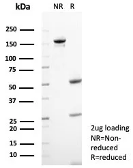 SDS-PAGE Analysis of Purified CD23 Recombinant Rabbit Monoclonal Antibody (FCER2/8235R). Confirmation of Purity and Integrity of Antibody.