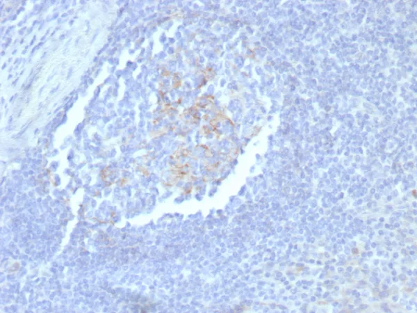 Formalin-fixed, paraffin-embedded human tonsil stained with CD23 Recombinant Rabbit Monoclonal Antibody (FCER2/8235R). HIER: Tris/EDTA, pH9.0, 45min. 2°C: HRP-polymer, 30min. DAB, 5min.