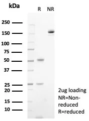 SDS-PAGE Analysis of Purified CD23 Recombinant Rabbit Monoclonal Antibody (FCER2/8236R). Confirmation of Purity and Integrity of Antibody.