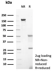 SDS-PAGE Analysis of Purified CD23 Recombinant Rabbit Monoclonal Antibody (FCER2/8237R). Confirmation of Purity and Integrity of Antibody.