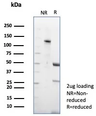 SDS-PAGE Analysis of Purified CD23 Recombinant Rabbit Monoclonal Antibody (FCER2/8510R). Confirmation of Purity and Integrity of Antibody.