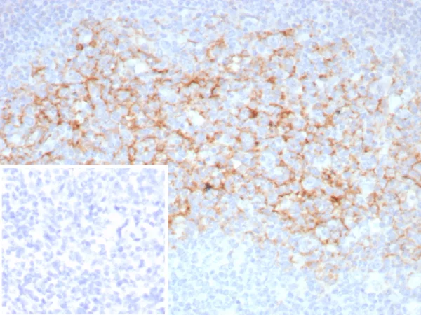 Formalin-fixed, paraffin-embedded human tonsil stained with CD23 Recombinant Rabbit Monoclonal Antibody (FCER2/8510R). Inset: PBS instead of primary antibody; secondary only negative control.