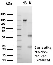 SDS-PAGE Analysis of Purified CD23 Recombinant Rabbit Monoclonal Antibody (FCER2/8511R). Confirmation of Purity and Integrity of Antibody.