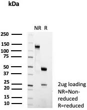 SDS-PAGE Analysis of Purified CD23 Recombinant Rabbit Monoclonal Antibody (FCER2/6474R).  Confirmation of Purity and Integrity of Antibody.