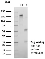 SDS-PAGE Analysis of Purified CD64 Mouse Monoclonal Antibody (FCGR1A/7496). Confirmation of Integrity and Purity of Antibody.