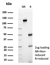 SDS-PAGE Analysis of Purified CD64 Mouse Monoclonal Antibody (FCGR1A/7498). Confirmation of Integrity and Purity of Antibody.