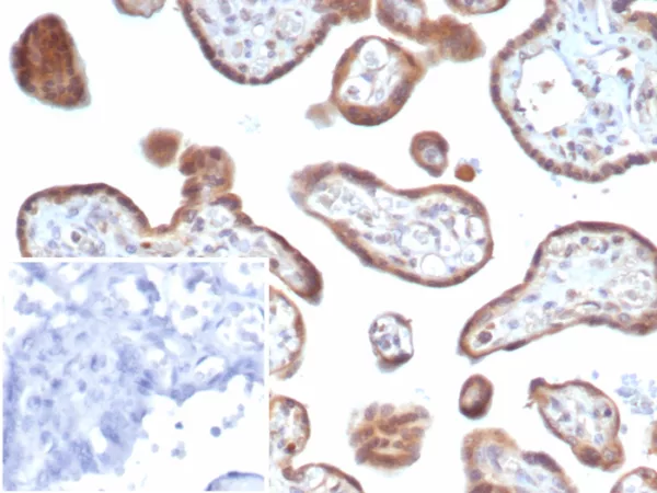 Formalin-fixed, paraffin-embedded human placenta stained with FGF2 Mouse Monoclonal Antibody (FGF2/7364). Inset: PBS instead of primary antibody; secondary only negative control.