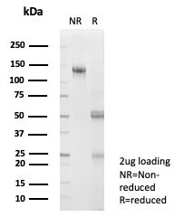 SDS-PAGE Analysis of Purified SNW1 Mouse Monoclonal Antibody (PCRP-SNW1-2A1). Confirmation of Purity and Integrity of Antibody.