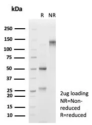SDS-PAGE Analysis of Purified FOXL1 Mouse Monoclonal Antibody (PCRP-FOXI1-1C4). Confirmation of Purity and Integrity of Antibody.