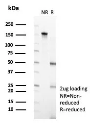 SDS-PAGE Analysis of Purified POGZ Mouse Monoclonal Antibody (PCRP-POGZ-1B2). Confirmation of Purity and Integrity of Antibody.