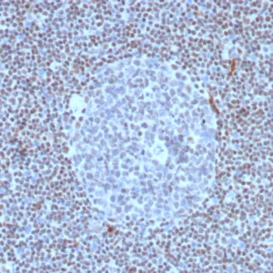 Formalin-fixed, paraffin-embedded human lymph node stained with Fli1 Recombinant Rabbit Monoclonal Antibody (FLI1/8318R). HIER: Tris/EDTA, pH9.0, 45min. 2°C: HRP-polymer, 30min. DAB, 5min.