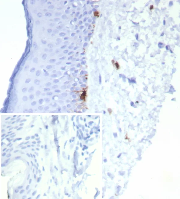 Formalin-fixed, paraffin-embedded human skin stained with  MART-1 Recombinant Mouse Monoclonal Antibody (rMLANA/8134).  Inset: PBS instead of primary antibody; secondary only negative control.