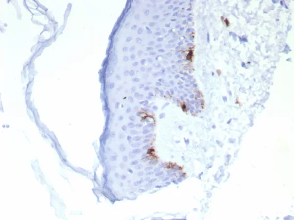 Formalin-fixed, paraffin-embedded human skin stained with  MART-1 Recombinant Mouse Monoclonal Antibody (rMLANA/8134). HIER: Tris/EDTA, pH9.0, 45min. 2°C: HRP-polymer, 30min. DAB, 5min.