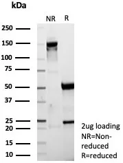 SDS-PAGE Analysis of Purified MART-1 Recombinant Mouse Monoclonal Antibody (rMLANA/9404). Confirmation of Purity and Integrity of Antibody.