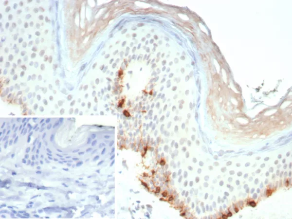Formalin-fixed, paraffin-embedded human skin stained with  MART-1 Recombinant Mouse Monoclonal Antibody (rMLANA/9404). Inset: PBS instead of primary antibody; secondary only negative control.