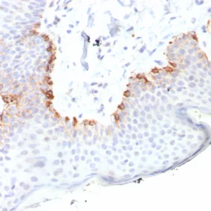 Formalin-fixed, paraffin-embedded human skin stained with MART-1 Recombinant Rabbit Monoclonal Antibody (MLANA/8108R). HIER: Tris/EDTA, pH9.0, 45min. 2: HRP-polymer, 30min. DAB, 5min.