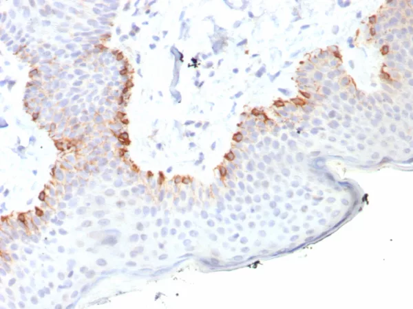 Formalin-fixed, paraffin-embedded human skin stained with MART-1 Recombinant Rabbit Monoclonal Antibody (MLANA/8108R). HIER: Tris/EDTA, pH9.0, 45min. 2: HRP-polymer, 30min. DAB, 5min.