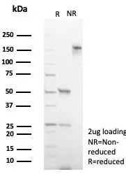 SDS-PAGE Analysis of Purified DBC2 Mouse Monoclonal Antibody (DBC2/4570).  Confirmation of Purity and Integrity of Antibody.