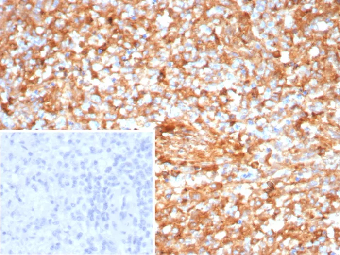 Formalin-fixed, paraffin-embedded human spleen stained with ICOS-L Mouse Monoclonal Antibody (ICOSL/7700). Inset: PBS instead of primary antibody; secondary only negative control. ICOS-L / ICOS Ligand / B7RP-1 (Immuno-Oncology Target) Antibody