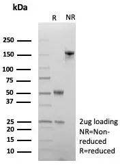 SDS-PAGE Analysis  Purified SATB2 Mouse Monoclonal Antibody (SATB2/7488). Confirmation of Purity and Integrity of Antibody.