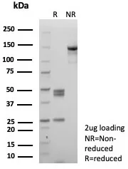 SDS-PAGE Analysis of Purified SATB2 Recombinant Mouse Monoclonal Antibody (rSATB2/8634). Confirmation of Purity and Integrity of Antibody.