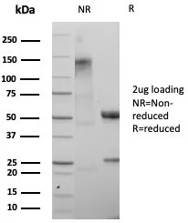 SDS-PAGE Analysis of Purified SATB2 Recombinant Mouse Monoclonal Antibody (rSATB2/8635). Confirmation of Purity and Integrity of Antibody.
