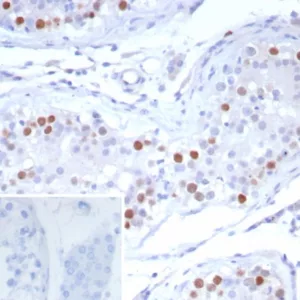 Formalin-fixed, paraffin-embedded human testis stained with PRAME Rabbit Monoclonal Antibody (PRAME/6928R). Inset: PBS instead of primary antibody; secondary only negative control.