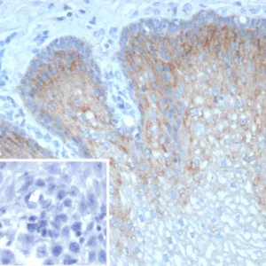 Formalin-fixed, paraffin-embedded human esophagus stained with TRIM29 Recombinant Rabbit Monoclonal Antibody (TRIM29/9256R). Inset: PBS instead of primary antibody; secondary only negative control.