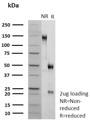 SDS-PAGE Analysis of Purified TRIM29 Recombinant Rabbit Monoclonal Antibody (TRIM29/9257R). Confirmation of Purity and Integrity of Antibody.