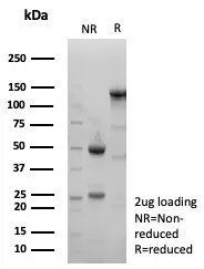 SDS-PAGE Analysis of Purified xCT Recombinant Rabbit Monoclonal Antibody (SLC7A11/9136R). Confirmation of Purity and Integrity of Antibody.