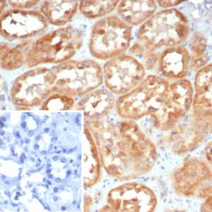 Formalin-fixed, paraffin-embedded human kidney stained with LAMP5 Mouse Monoclonal Antibody (LAMP5/7642). Inset: PBS instead of primary antibody; secondary only negative control.