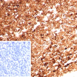 Formalin-fixed, paraffin-embedded human tonsil stained with  Ferritin, HC Recombinant Rabbit Monoclonal Antibody (FTH/8700R). HIER: Tris/EDTA, pH9.0, 45min. 2: HRP-polymer, 30min. DAB, 5min.