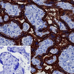 Formalin-fixed, paraffin-embedded human placenta stained with PLAP Rabbit Recombinant Monoclonal Antibody (ALPP/8112R). Inset: PBS instead of primary antibody; secondary only negative control.