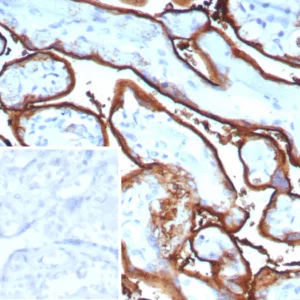 Formalin-fixed, paraffin-embedded human tonsil stained with PLAP Recombinant Rabbit Monoclonal Antibody (ALPP/9109R). Inset: PBS instead of primary antibody; secondary only negative control.