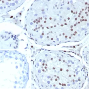 Formalin-fixed, paraffin-embedded human testis stained with SF-1 Recombinant Rabbit Monoclonal Antibody (SF1/8000R). Inset: PBS instead of primary antibody; secondary only negative control.