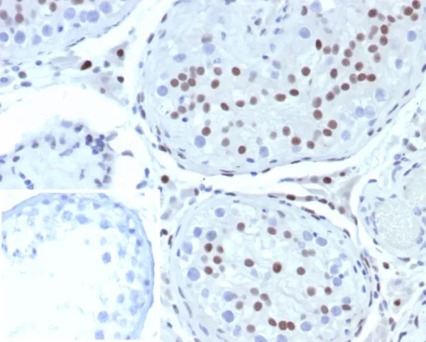 Formalin-fixed, paraffin-embedded human testis stained with SF-1 Recombinant Rabbit Monoclonal Antibody (SF1/8000R). Inset: PBS instead of primary antibody; secondary only negative control.