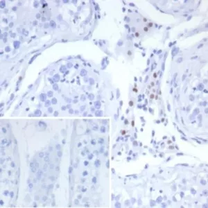 Formalin-fixed, paraffin-embedded human testis stained with SF-1 Recombinant Rabbit Monoclonal Antibody (SF1/8150R). Inset: PBS instead of primary antibody; secondary only negative control.