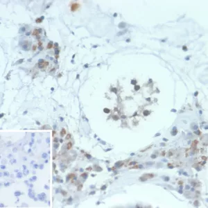 Formalin-fixed, paraffin-embedded human testis stained with HGAL Mouse Monoclonal Antibody (HGAL/2834). Inset: PBS instead of primary antibody; secondary only negative control.