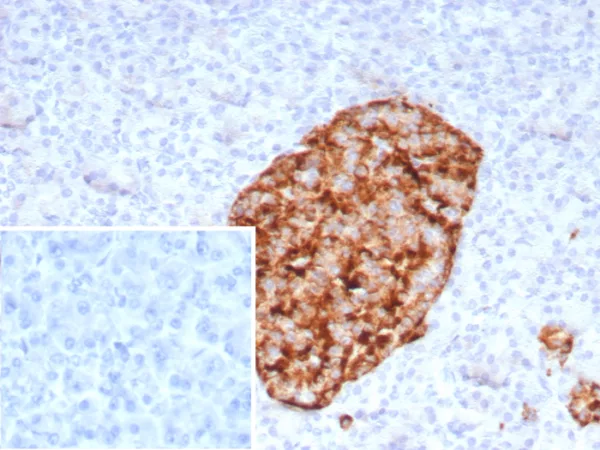 Formalin-fixed, paraffin-embedded human pancreas stained with GAD2 Recombinant Mouse Monoclonal Antibody (rGAD2/9382). Inset: PBS instead of primary antibody; secondary only negative control.