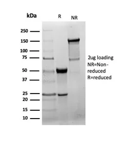 SDS-PAGE Analysis of Purified GAD2 Recombinant Rabbit Monoclonal Antibody (GAD2/6488R). Confirmation of Integrity and Purity of Antibody.