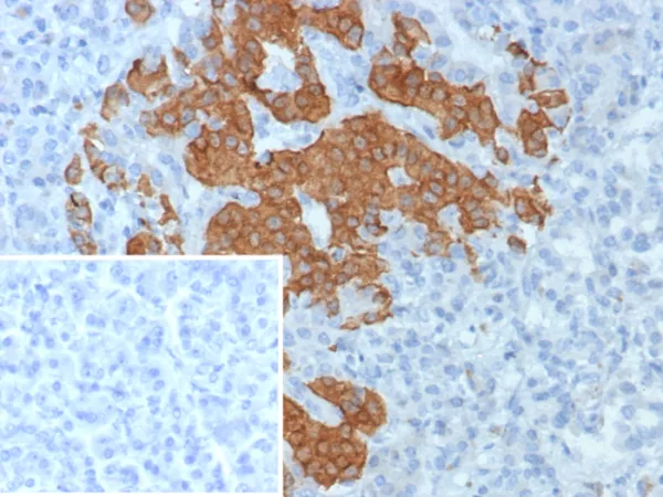 Formalin-fixed, paraffin-embedded human pancreas stained with GAD2 Recombinant Rabbit Monoclonal Antibody (GAD2/8394R). Inset: PBS instead of primary antibody; secondary only negative control.