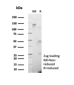SDS-PAGE Analysis of Purified GAD2 Recombinant Rabbit Monoclonal Antibody (GAD2/8547). Confirmation of Integrity and Purity of Antibody.