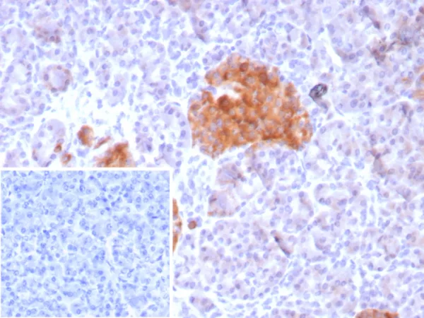 Formalin-fixed, paraffin-embedded human pancreas stained with GAD2 Recombinant Rabbit Monoclonal Antibody (GAD2/8547). HIER: Tris/EDTA, pH9.0, 45min. 2°C: HRP-polymer, 30min. DAB, 5min.