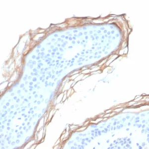 Formalin-fixed, paraffin-embedded human skin stained with Kallikrein 5 Mouse Monoclonal Antibody (KLK5/3855). HIER: Tris/EDTA, pH9.0, 45min. 2°C: HRP-polymer, 30min. DAB, 5min.