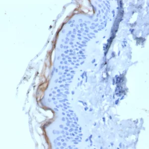 Formalin-fixed, paraffin-embedded human skin stained with Kallikrein 5 Mouse Monoclonal Antibody (KLK5/4759). HIER: Tris/EDTA, pH9.0, 45min. 2°C: HRP-polymer, 30min. DAB, 5min.